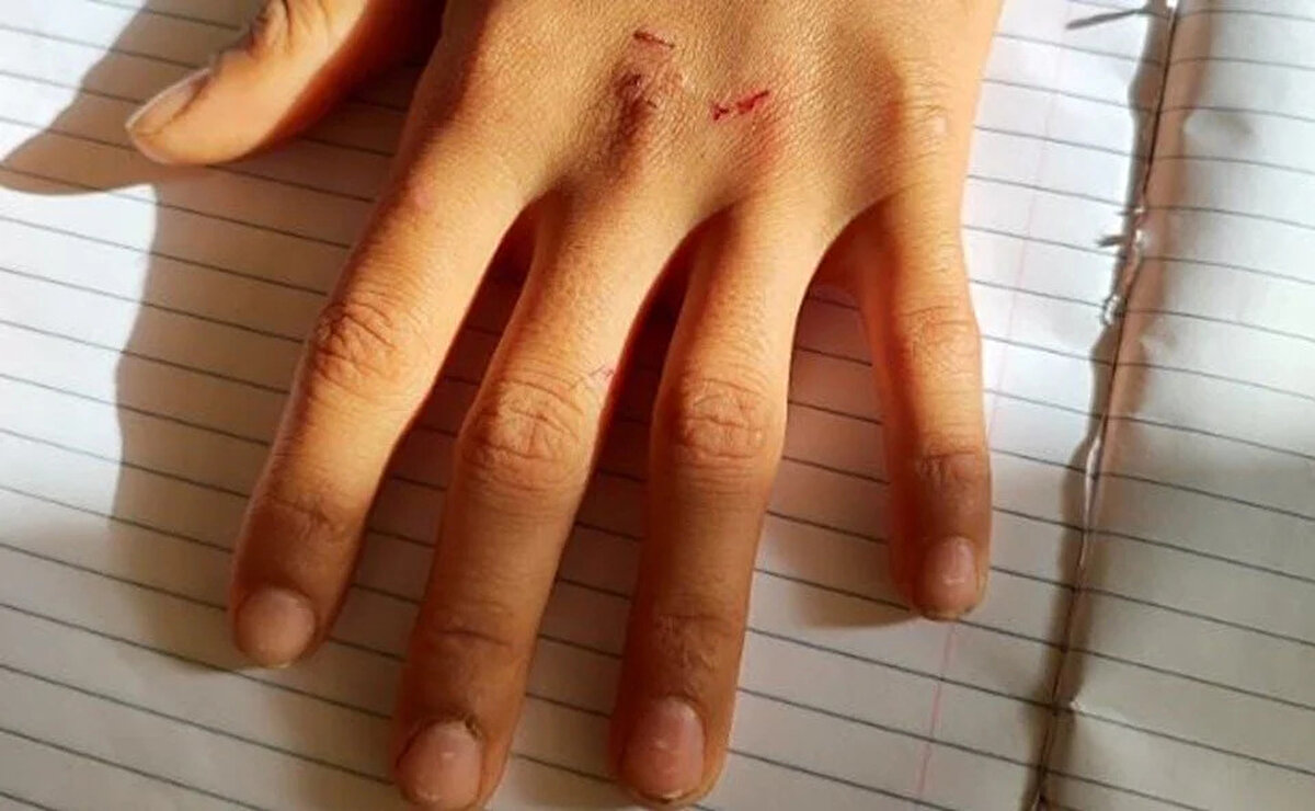 Akımın hızla yayılması üzerine durumun farkedildiği okullarda yasak kararı geldi. Ancak birçok öğrenci yasak olmasına rağmen bu oyunu oynamaya devam ediyor.