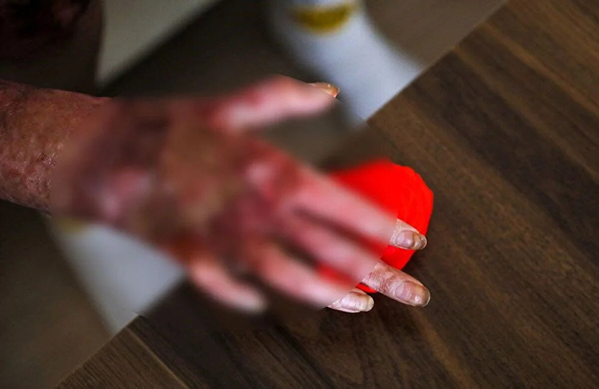 EĞİTİM İÇİN RAPOR BEKLİYOR<br>Çocukluğundan bu yana arabalara merakı olduğunu belirten Hatmorioğlu, "Çocukluktan bu yana arabaların içerisindeyim ve vazgeçemedim. Bu kadar biliyorken; 'Okulunu da okuyayım' dedim. Çıraklık okulunda son senemi tamamlayacaktım. Tedavi sürecimden dolayı bu yıl devam edemeyeceğim. Okula heyet raporu götürmemiz gerekiyor ancak hala onunla uğraşıyoruz" diye konuştu.<br><br>'AYNAYA ÇOK ZOR BAKTIM'<br><br>Hatmorioğlu, "Tedavi ne kadar uzun sürerse sürsün, işime devam etmek istiyorum. İnsan mesleği olunca vazgeçemiyor. Kadın olduğum için bu konuyla alakalı çok yargılandım. Genelde benim suçum olduğu düşünülüyor. Kadın olmakla bunun bir alakası yok ayrıca olayda bir hatam da yok. Hastaneden çıktıktan sonra aynaya çok zor baktım. Eski fotoğraflarıma bakınca üzülüyorum. Kendimi şu anki halim ile benzetemiyorum. Benim için üzücü bir süreç" dedi.