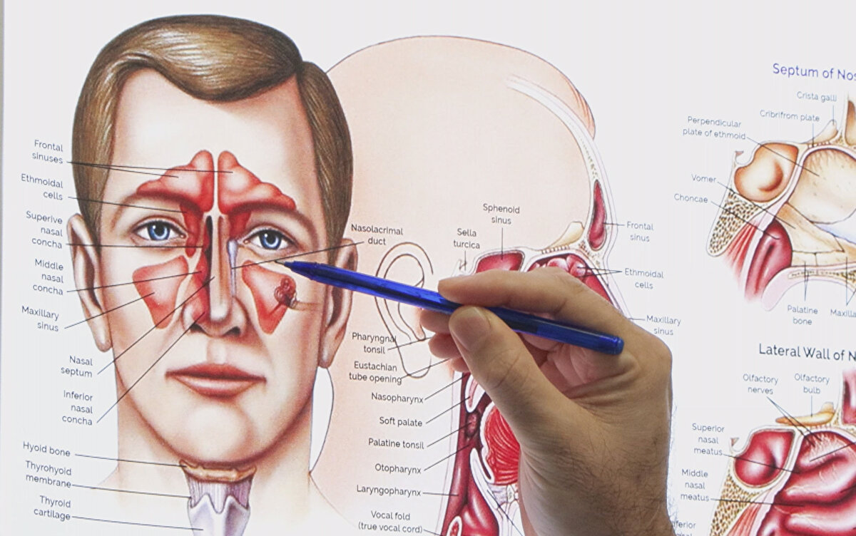  Prof. Dr. Apuhan, "Maksiller sinüs tümörü olarak adlandırılan bu tümör çok nadir görülür. Genellikle sinüzit veya diş ağrısıyla karıştırıldığı için sinsi ilerler ve geç teşhis edilir. Hastamız 1 ay daha geç kalsaydı sol gözünü de almak zorunda kalacaktık. Tümörü komple temizledik.  Radyoterapi ile tedavisi tamamlanacak ve yanak içine protez konarak kozmetik düzeltme de yapılacak" dedi. Uzun süren tek taraflı burun tıkanıklığı ve kanaması, yanakta kitle olduğu durumlarda bu açıdan da hasta değerlendirilmeli" dedi. Tekin'in 34 yıllık eşi Hülya Tekin ise yaşadıklarını anlatırken gözyaşlarını tutamadı eşinin, 4 ay sonra doğacak ilk torunlarını kucağına alabileceği için çok mutlu olduğunu söyledi.