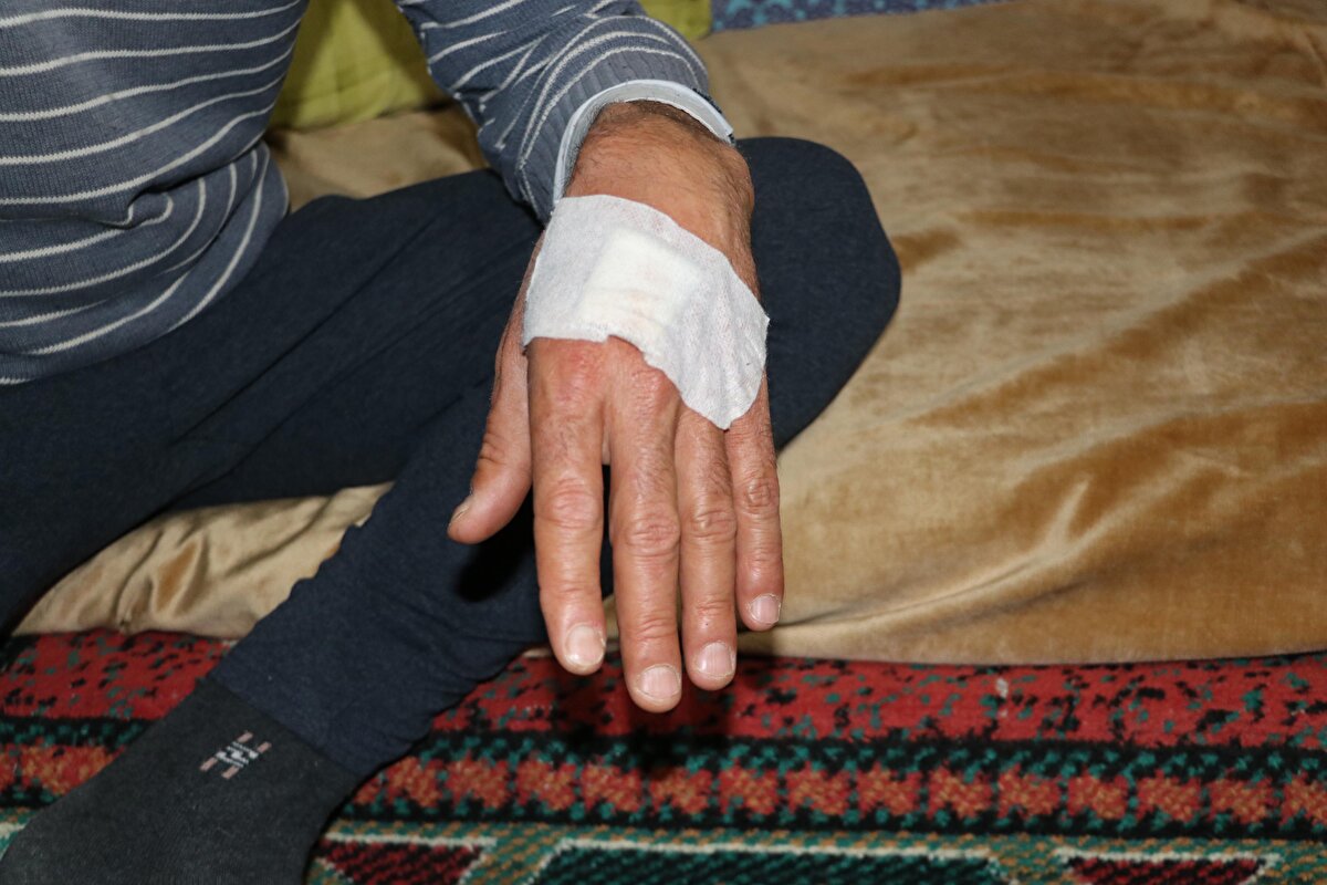 'BENİ PARÇALAMAYA UĞRAŞTI'<br>Tedavisinin ardından taburcu olan Murat Akyatak, saldırı sırasında kaçmaya fırsatı olmadığını söyledi. Akyatak, “Merada ayı, derenin içindeymiş görmedim. Koyunları çevirdim eve dönmek için, ayı üzerime saldırdı. Zaten çok yakınmışız, kaçmaya fırsat da bırakmadı bize. Bir anda saldırdı. Sonra da ayaklarıma daldı. Ayaklarıma saldırınca beni devirdi ve ısırmaya başladı. Beni parçalamaya uğraştı. Sonra sürüdeki köpekler ayıya saldırdı. Köpeklerin saldırısı sonrası ayı beni bıraktı. Ben 53 yaşındayım ilk kez buralarda ayı gördüm. Çok kilolu bir ayıydı. Kurtulmak için çok mücadele ettim ve en sonunda köpekler kurtardı. Yoksa köpekler olmasaydı biz yaşamayacaktık, yani öteki dünyaya gitmiştik şu anda" dedi.