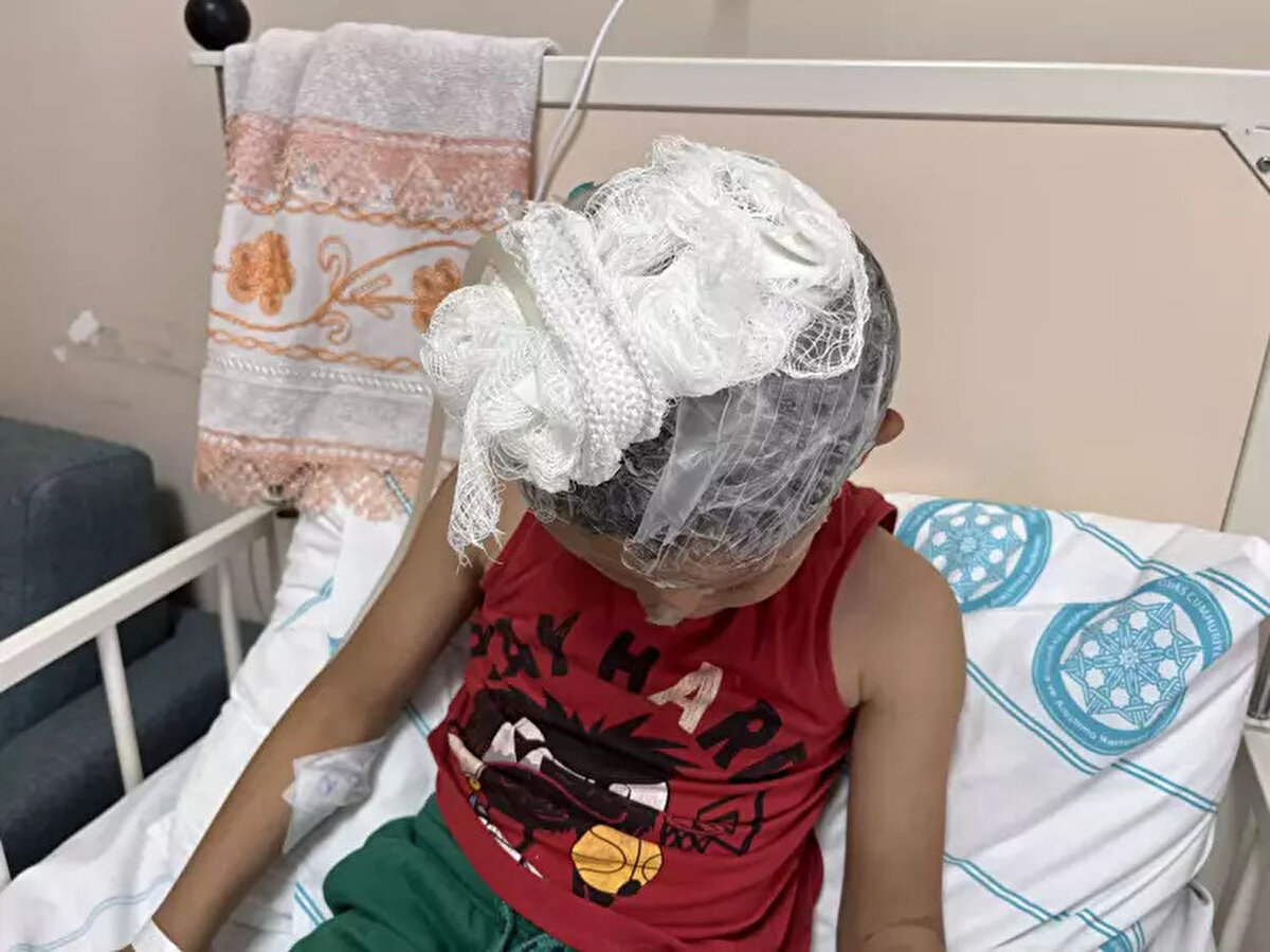 Buna kimse müdahale de etmiyor. Köye her yerden köpek getirip bırakıyorlar. Şu an büyük sıkıntıdayız. Çok başıboş köpek var. Köpek çocuğumun kafasından tutmuş. 3 sefer ameliyat geçirdi.