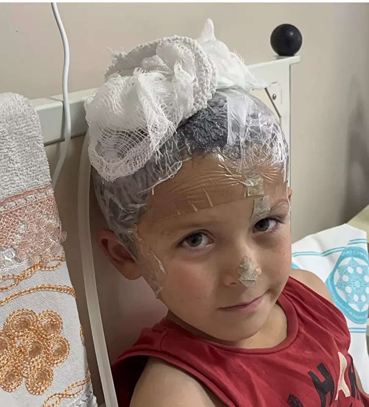 Hayati tehlikesi vardı. 3 gün boyunca kendine gelemedi. Psikolojik olarak da baya kötüydü. Bugün benim çocuğuma saldıran köpekler, yarın başka çocuklara da saldıracak. Bizim köyümüze gerekenin yapılmasını istiyorum" dedi.