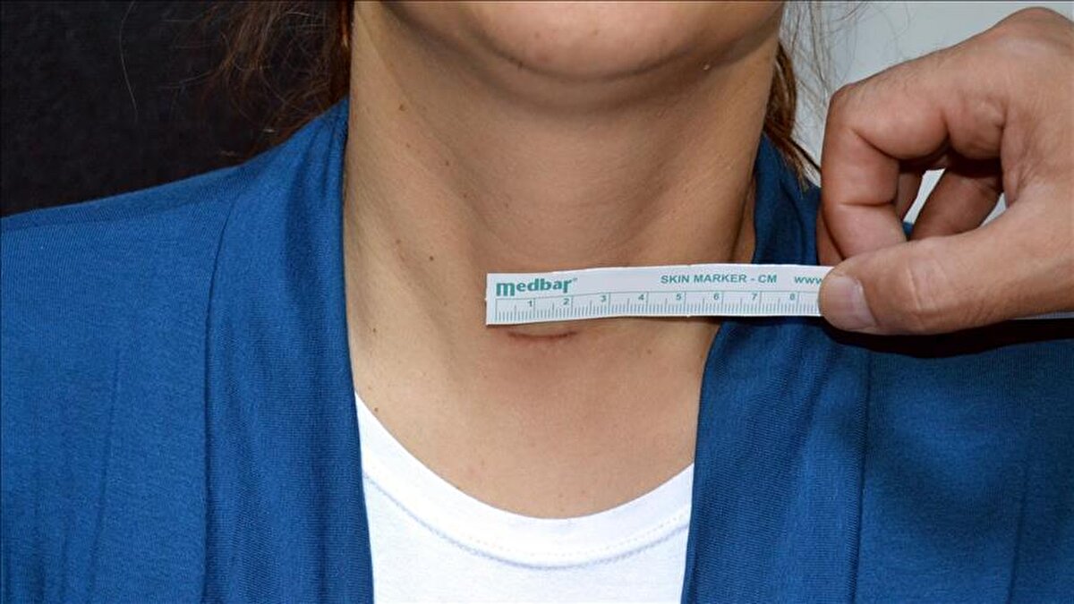 Sağlıklı beslenme ve kalp sağlığıyla ilgili verdiği tavsiyelerle adından sıkça söz ettiren iç hastalıkları uzmanı Prof. Dr. Canan Karatay, bu defa belirtilerini tek tek sayarak tehlikeli bir hastalığa karşı uyarıda bulundu.