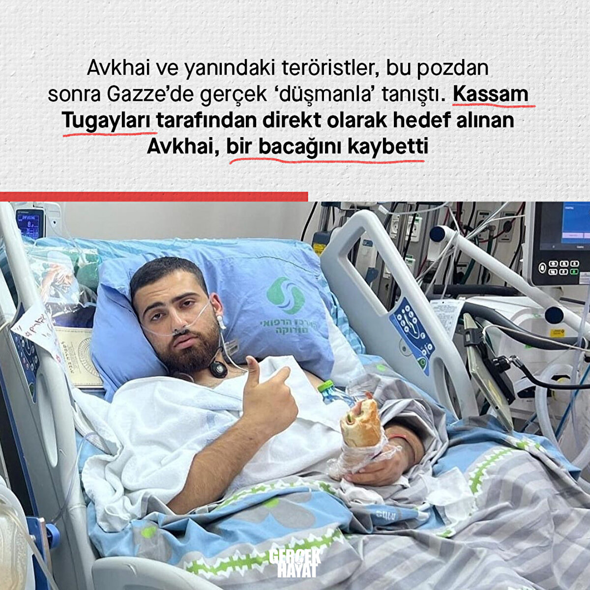 Kassam Tugayları tarafından direkt olarak hedef alınan Avkhai, bir bacağını kaybetti