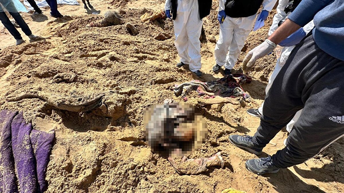 İsrail ordusu, Gazze kentinin batısında bulunan, 7 binden fazla hasta ve yerinden edilmiş Filistinlinin sığındığı Şifa Hastanesine 18 Mart`ın ilk saatlerinde baskın düzenlemiş ve Filistinlilerin sığındığı yerleşkeyi kuşatmıştı.<br><br>Gazze`deki hükümet, İsrail güçlerinin Şifa Hastanesi ve çevresinde 400`den fazla Filistinliyi öldürdüğünü, 900`den fazlasını alıkoyduğunu ve 1050 evi yıktığını duyurmuştu.