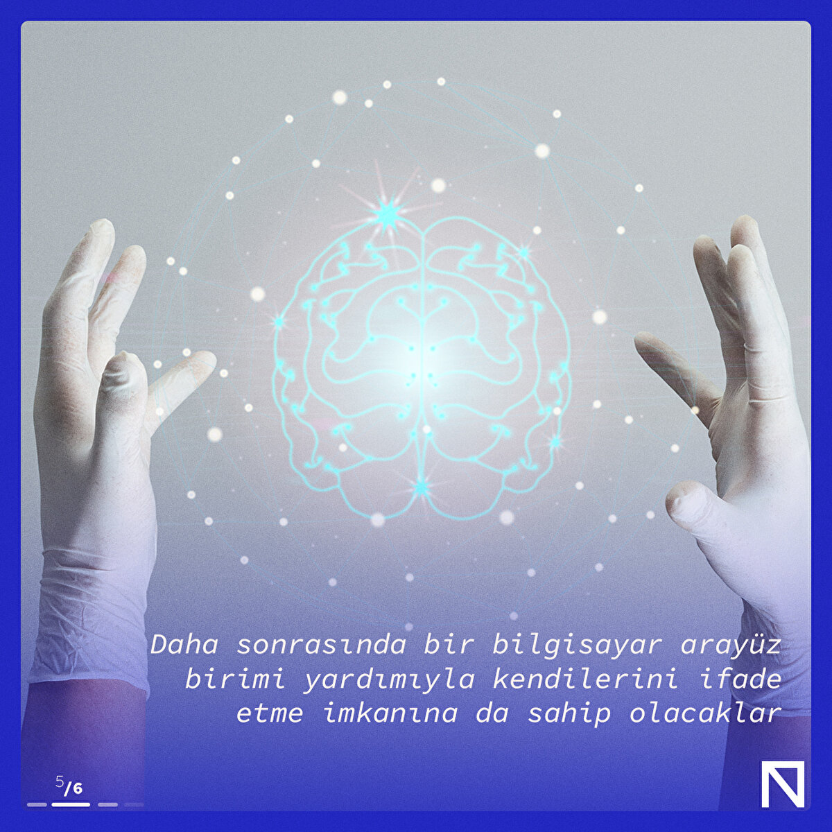 Daha sonrasında bir bilgisitar arayüz birimi yardımıyla kendilerini ifade etme imkanına da sahip olacaklar