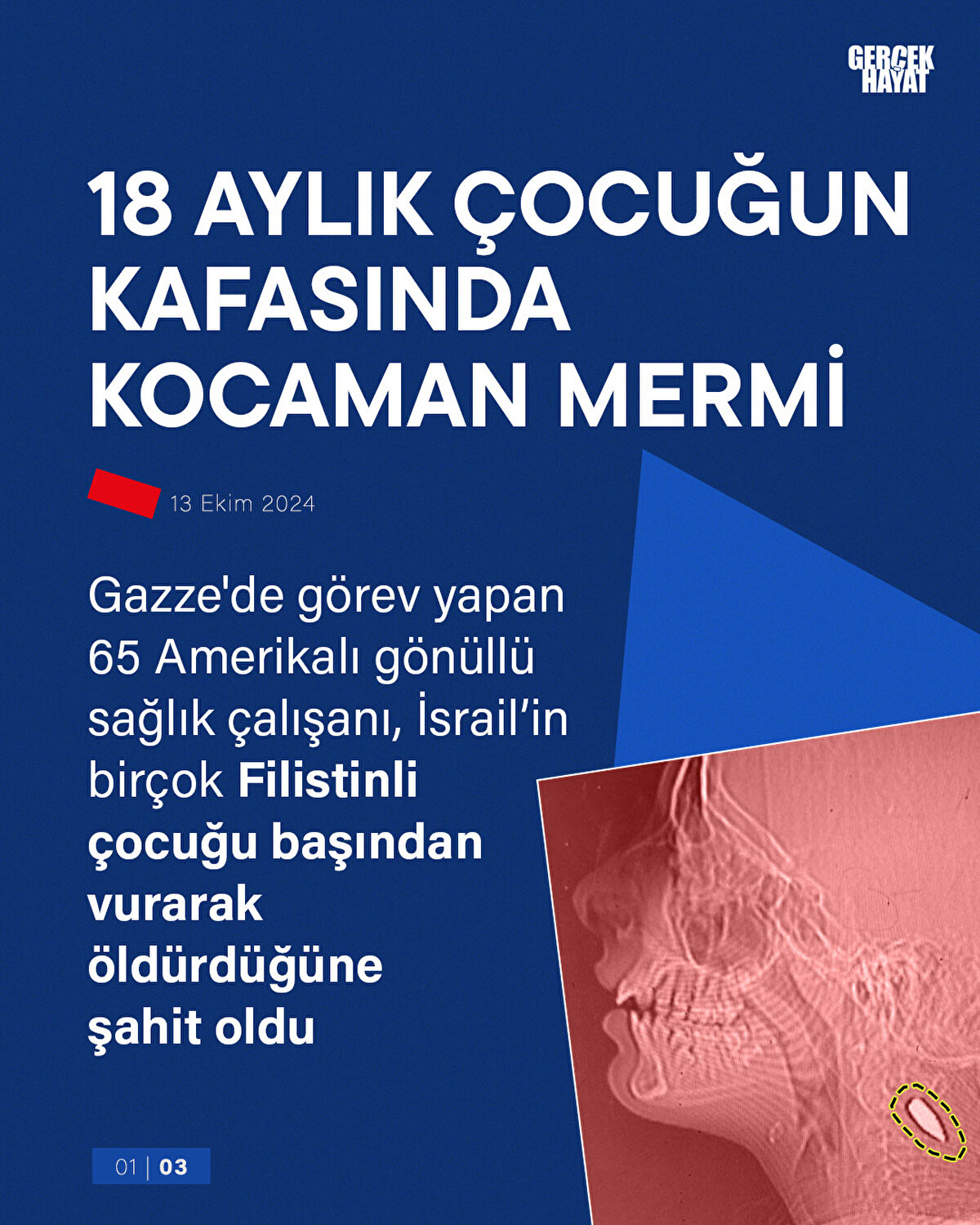 Gazze'de görev yapan 65 Amerikalı gönüllü sağlık çalışanı, İsrail’in birçok Filistinli çocuğu başından vurarak öldürdüğüne şahit oldu