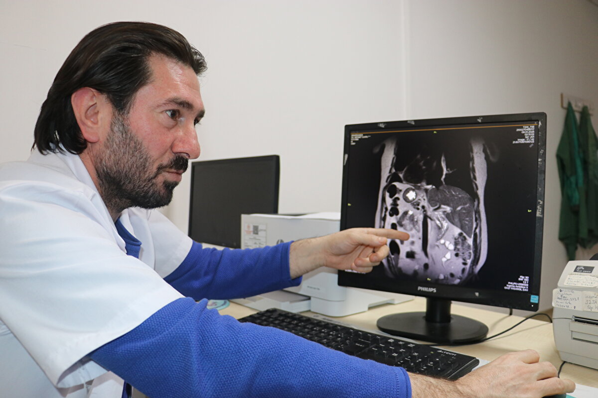 "İlk defa gördükleri için şaşırıyorlar"<br><br>Operasyonun güzel geçtiğini ve durumunun iyi olduğunu belirten Mehmet Şükrü Ak da "Organlarımın ters tarafta olduğunu, burnumdan ameliyat olacağım vakit öğrendim. Geçen hafta arkadaşımın iş yerindeyken mide tarafında sancılarım oldu ve acile geldim. Röntgenlerimi çektikten sonra doktorlar organlarımın ters tarafta olduğunu söyleyip, safra kanalında taşların olduğunu söyleyerek, yatışımı yaptılar. ERCP işlemi ile taşlarımı çıkardılar. Şu an iyiyim. Allah razı olsun, hocalarım yardımcı oldu. Astım hastasıyım, devamlı hastaneye geliyorum. Sağlıkçılar röntgenimi çektikten sonra bana organlarımın ters tarafta olduğunu söylüyorlar. Ben de onlara bildiğimi söyledikten sonra bana neden söylemediğimi söylüyorlar. Bazı sağlıkçılar organlarımın ters tarafta olduğunu fark edince ve ilk defa gördükleri için çok şaşırıyorlar" diye konuştu. <br>