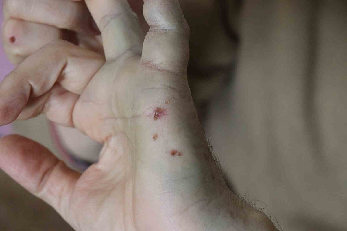 Tek amacı beğenmediği ürünü iade etmek olan Şevket Kaya ile kendisini mağaza sorumlusu olarak tanıtan kadın ile arasında tartışma çıktı. Çıkan tartışma üzerine kendisinden güçsüz olan emekli öğretmene saldıran kadın, yaşlı adamı yüzü ve göğsünden tırmalayarak yaraladı. Isırdığı emekli öğretmenin elini kanatan kadın, onu marketin deposuna kilitledi. Polise yapılan ihbar sonucu gözaltına alınarak karakola götürülen Kaya, yaşadığı dehşet anlarının ardından bir de tacizle suçlanınca şoke oldu. Her iki tarafında birbirinden şikayetçi olduğu olayla ilgili olarak adli işlem başlatıldığı öğrenildi.