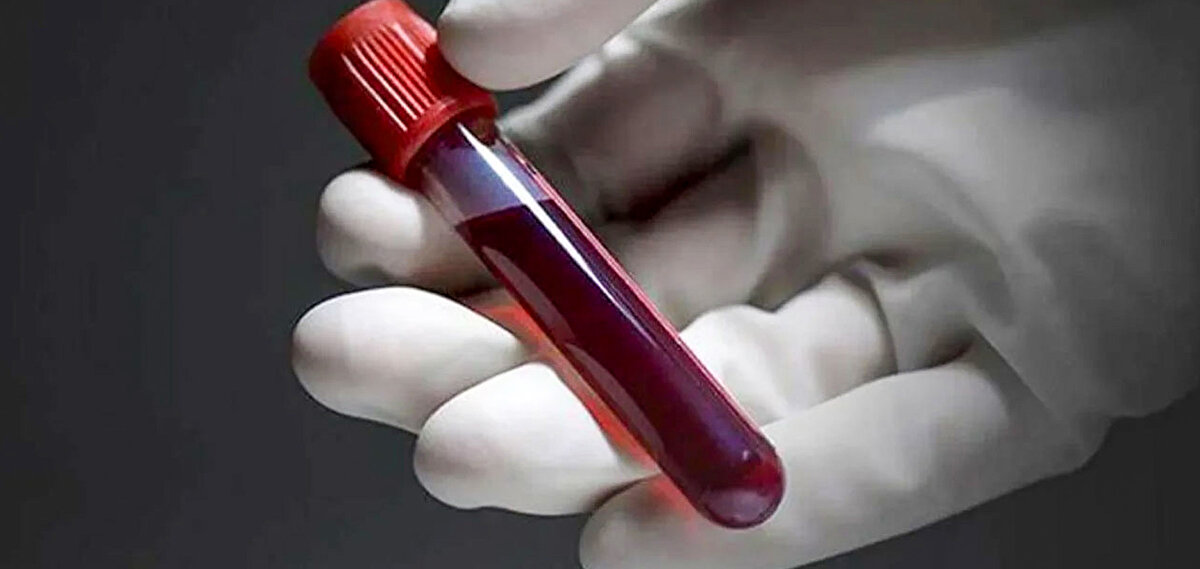 Bazı bilim insanları, elde edilen verilerin kesinlik taşımadığını savunurken, çalışmalarda sigara ve alkol kullanımı gibi faktörlerin yeterince dikkate alınmadığını vurguluyor.