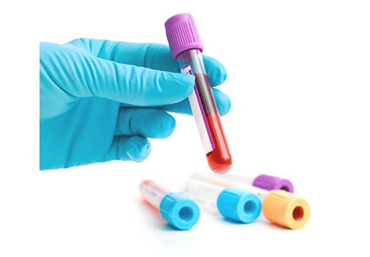 AB kan grubu ve karaciğer kanseri bağlantısı<br><br>2016 yılında yapılan başka bir araştırmada ise 18 bin kişi üzerinde inceleme yapıldı. Sonuçlara göre, AB kan grubuna sahip bireylerin karaciğer kanseri riskinin yüzde 45 daha fazla olduğu belirlendi.