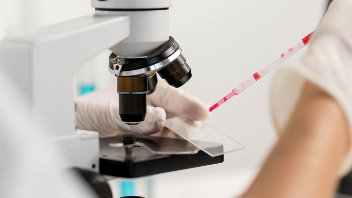 A kan grubu bağırsak kanseri riskini artırıyor <br><br>Bilim insanlarının elde ettiği verilere göre, A kan grubuna sahip bireylerin bağırsak kanserine yakalanma olasılığı da diğer gruplara kıyasla daha yüksek.