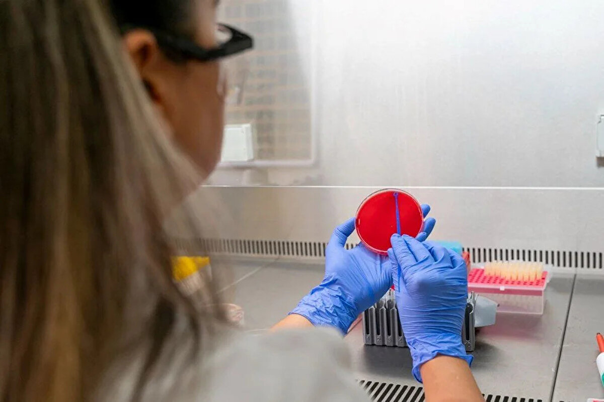 Bakteriyel menenjitin belirtileri:<br><br>- Ani yükselen ateş<br>- Şiddetli baş ağrısı<br>- Mide bulantısı ve kusma