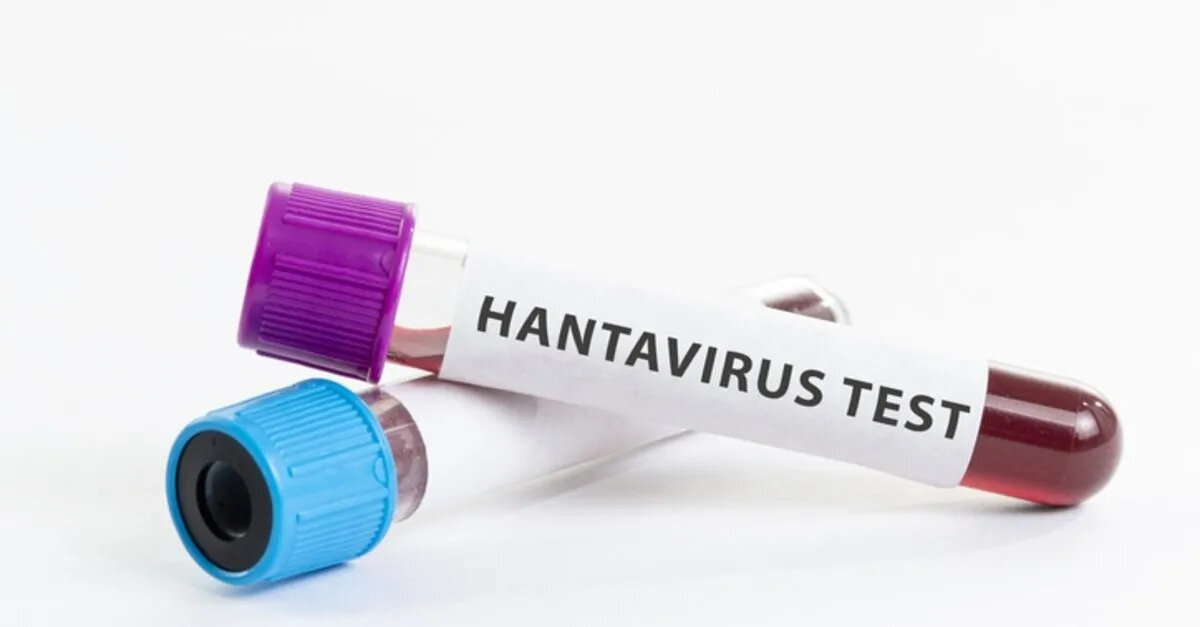 Tedavi ve korunma yöntemleri<br><br>Hantavirüse karşı hâlihazırda onaylanmış bir tedavi ya da aşı bulunmuyor. Ancak erken teşhis, tedavi sürecini olumlu etkileyebilir.