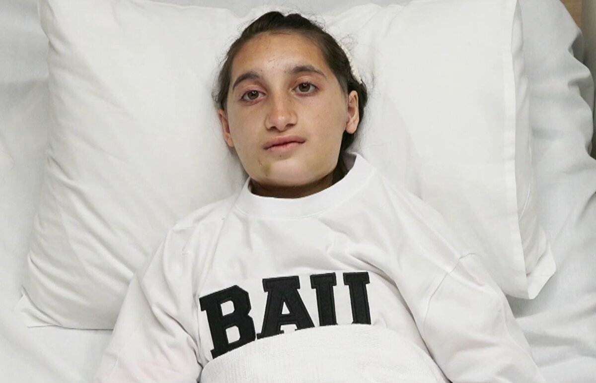 Ameliyattan ücret alınmadı<br><br>Tülem, genç kızın durumunu anlatarak, Varol’dan ameliyat için yardım istedi. Prof. Dr. Altan Varol, genç kızın durumunu öğrenince ameliyattan ücret almayacağını belirtti. Bunun üzerine Kokhreidze, İstanbul’a getirildi. Acıbadem Hastanesi’nde yedi saat süren başarılı bir ameliyat gerçekleştirildi. Genç kızın ameliyat sonrası enfeksiyon kapmaması için bir hastanede yatması gerekiyordu. Bahçeşehir Üniversitesi Diş Hekimliği Fakültesi, bu işlemi ücretsiz olarak gerçekleştirdi.