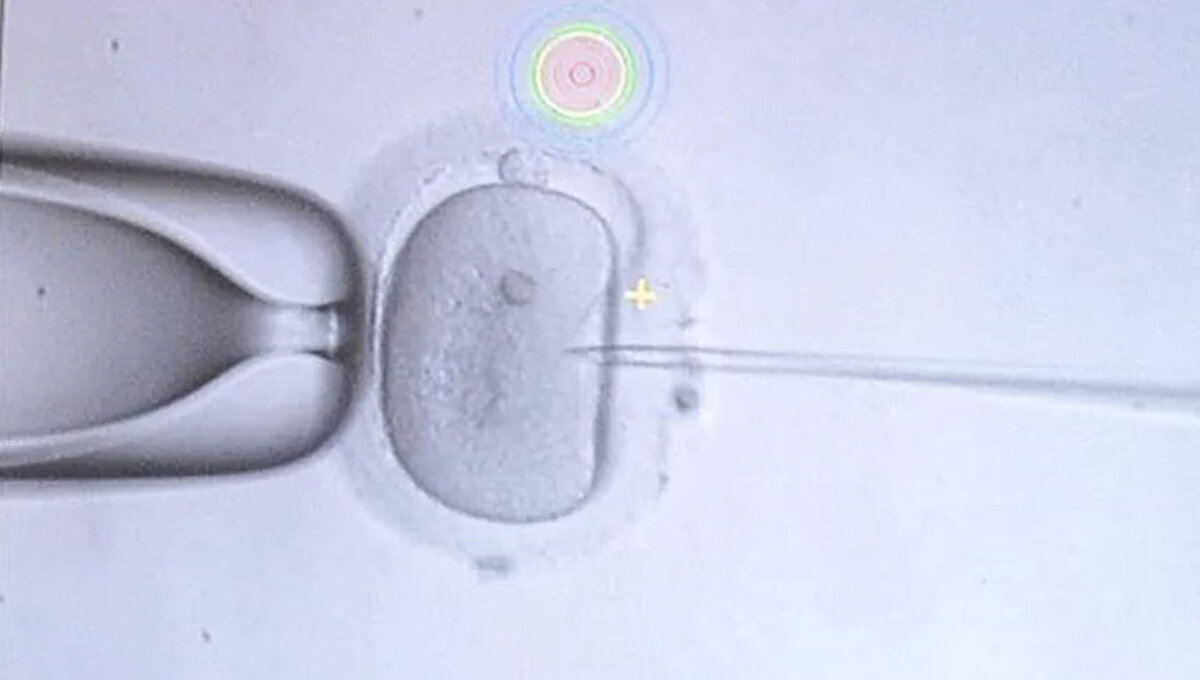 "Zararsız" denilen ilaçların ağır yan etkileri var<br><br>İddiaya göre, kadınlara verilen ilaçların “zararsız” olduğu söylendi; ancak ilacın prospektüsünde felçten erken menopoza kadar ciddi yan etkiler yer alıyor. Şikayet dilekçesinde bu uygulamanın, “organ kaçakçılığına zemin hazırladığı” ifade edildi.
