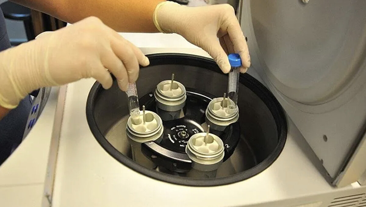 Bakanlık: Savunmalar yetersiz, konu ciddi<br><br>Ancak Sağlık Bakanlığı, doktorların savunmalarını yeterli bulmadı. İki doktor hakkında suç duyurusunda bulunarak, olayın ciddiyetine dikkat çekti ve adli süreç başlatılmasını talep etti.