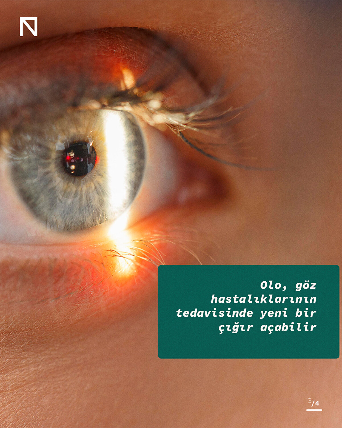 Olo, göz hastalıklarının tedavisinde yeni bir çığır açabilir