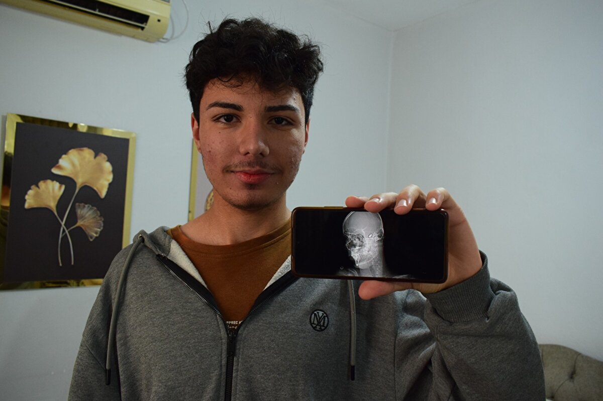 Ölüm korkusu yaşıyoruz. Her an oğluma bir şey olacak korkusu ile yaşıyorum. Bana bu korkuyu yaşatmaya kimsenin hakkı yoktu. Biz buna sebep olanların yakalanmasını, adalete teslim edilmesini istiyoruz. Oğlum eskiye göre çok çok daha iyi. Sağ elinde hafif problemler var, onları da inşallah en kısa zamanda atlatacak. Oğlum şu an yorgun mermi ile yaşayacak, müdahale edilemeyecek. Yani ileride bakılacak, müdahale edilebilecek durum varsa ancak o durumda çıkarılacak” diye konuştu.