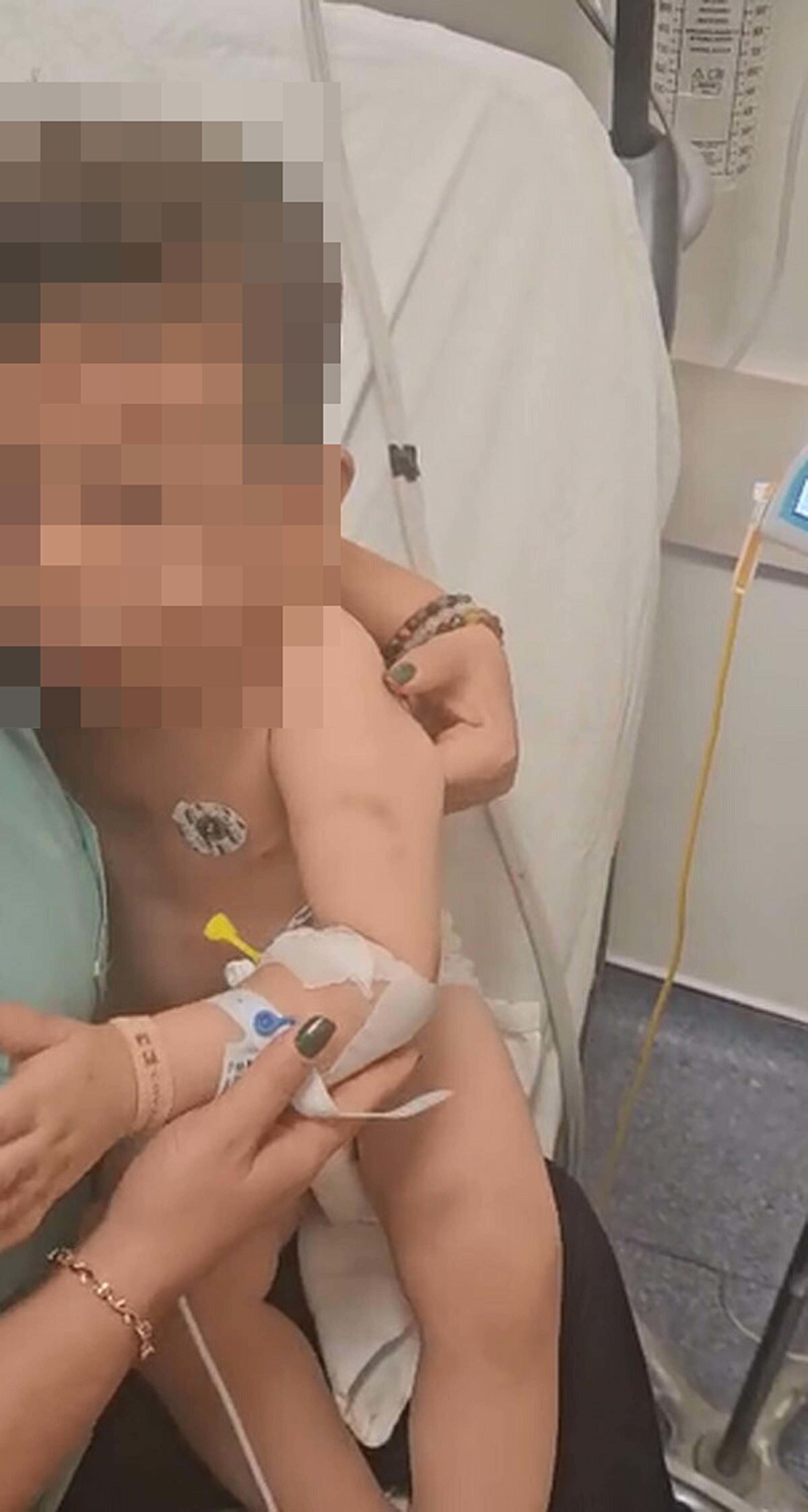 Anne Satı Buse D., ifadesinin ardından serbest bırakıldı. Hastanedeki tedavisi süren ve servise alınan bebeğin hayati tehlikeyi atlattığı, sağ gözünü kurtarmak için ameliyat edileceği öğrenildi.