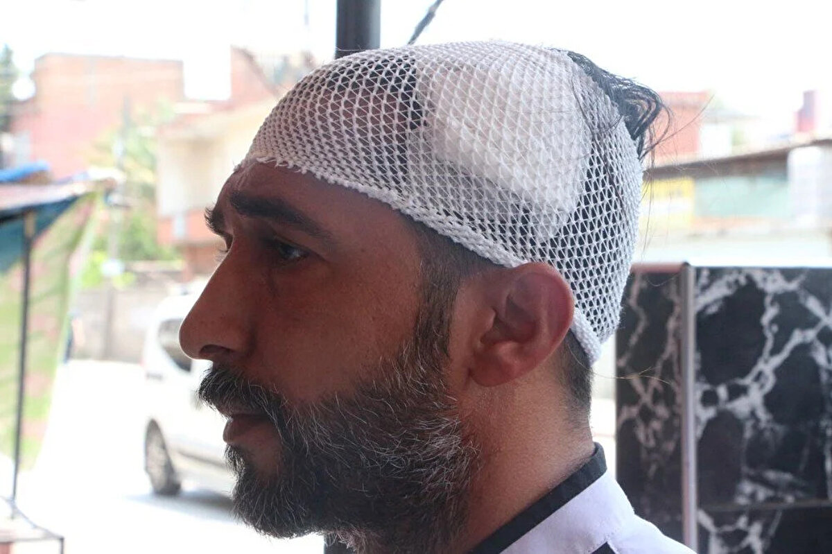 Seyhan'da 23 yıldır esnaflık yaptığını anlatan Malgir, "Olay günü müşterimin siparişini hazırlarken tam döner kestiğim sırada yukarıdan, iş yerinin tavanından düşen mermiyle sarsıldım. Neye uğradığımı şaşırdım." dedi.<br><br>Bir anda kafasından kanlar gelmeye başladığını anlatan Malgir, "Hastaneye kaldırıldım. Sonuçta mermi kafama geldi, ölebilirdim. Dört çocuğum babasız kalabilirdi." ifadelerini kullandı.<br><br>Kimseyle husumetinin olmadığını anlatan dönerci ustası, silahı ateşleyenin bulunmasını istedi.