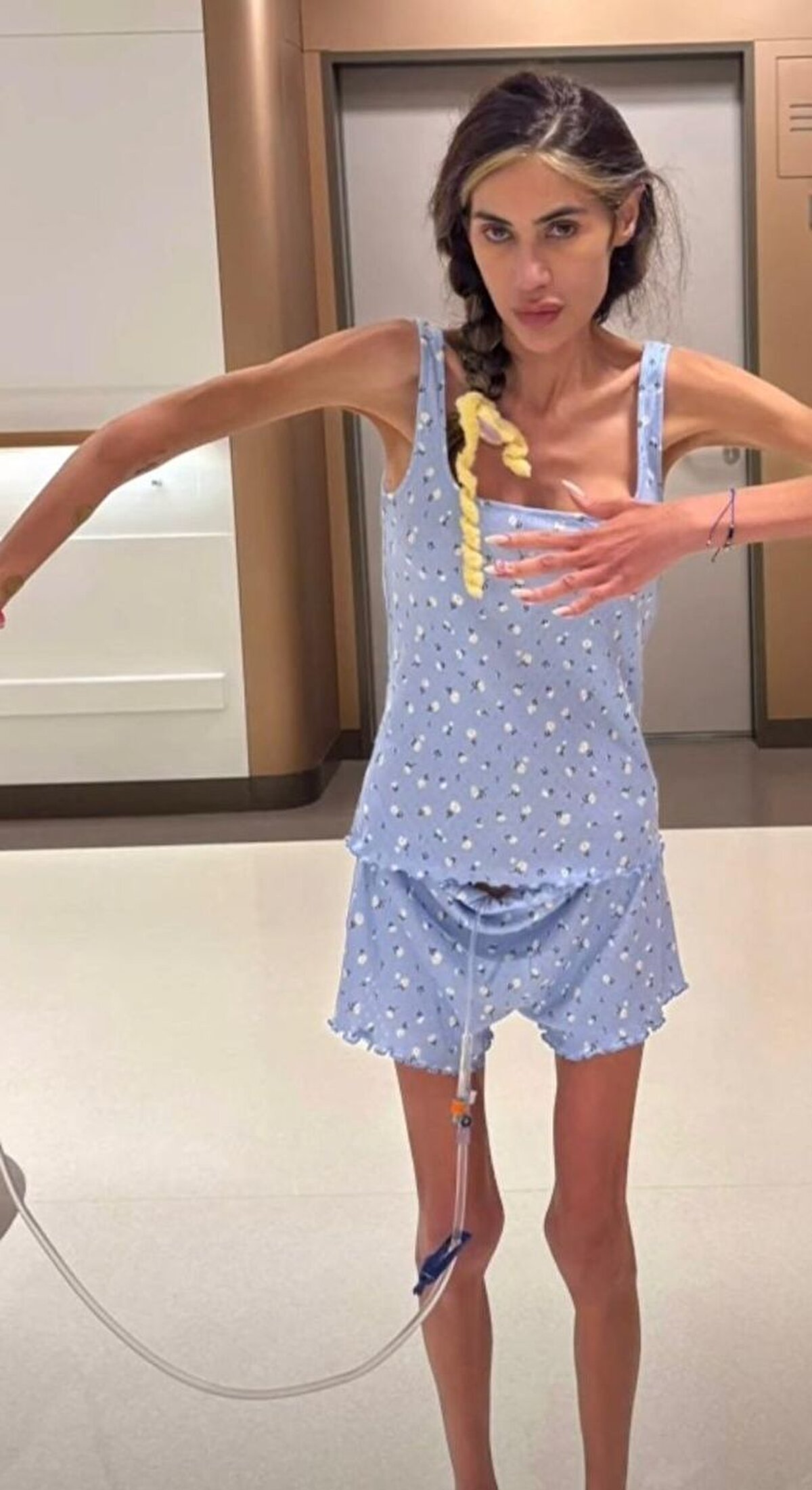 Modacı Candan'ın ailesiyle yeniden konuşarak Nihal Candan'ın son sağlık durumunu açıkladı.<br><br>Kerimoğlu Nihal Candan'ın devlet hastanesine yatırıldığını ve yoğun bakıma alındığını açıklayarak "Nihal yine istemiyorum demesine rağmen çok şükür alınmış" dedi.