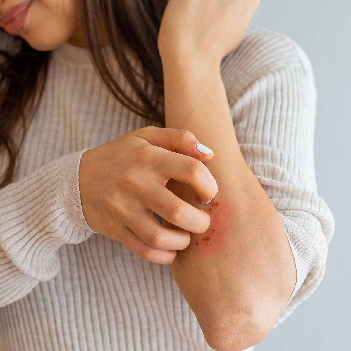 Bilim ne diyor?<br><br>Ohio Eyalet Üniversitesi’nden Entomoloji uzmanı Dr. Susan Jones, beyaz sirkenin keskin kokusundaki asetik asidin, sivrisineklerin koku alma reseptörlerini bozduğunu ve yön bulmalarını engellediğini belirtiyor. Jones, “Sivrisinekler kokuyla yön bulur. Beyaz sirkenin güçlü kokusu onların yön duygusunu şaşırtarak evlere girmelerini zorlaştırır” diyor.<br><br>Ayrıca Journal of Medical Entomology dergisinde yayımlanan bir çalışma, sirke bazlı yöntemlerin sivrisinek popülasyonunu %60’a kadar azaltabileceğini gösteriyor.