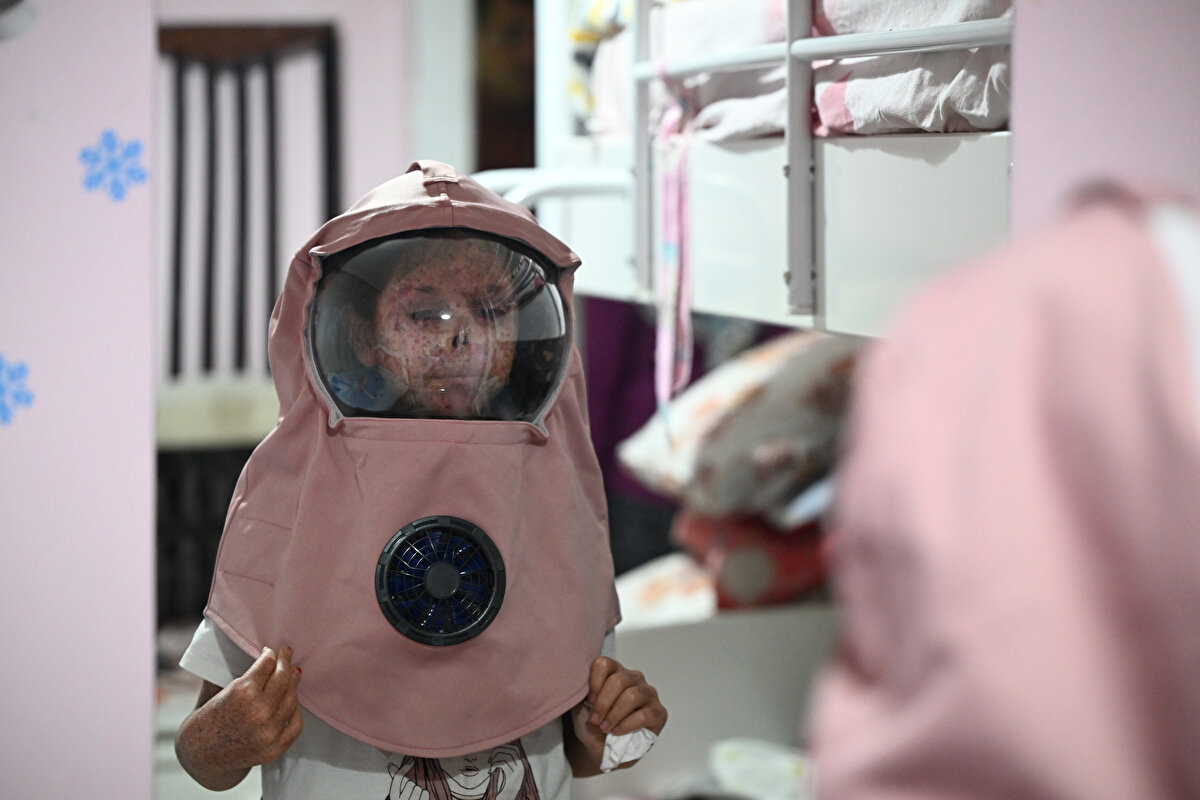 Kızının cilt kanseri riski taşıdığı için güneşe çıkamadığına değinen Bozkurt, "Gündüzleri eğlence ya da oyun durumu yok. Eskiden dışarıdaki seslere ilgisi vardı, pencereden bakardı ama şimdi dünyaya küsmüş gibi. Dışarıda kıyamet kopsa umursamıyor. Tedavi için maddi ve manevi desteğe ihtiyacımız var." ifadelerini kullandı.