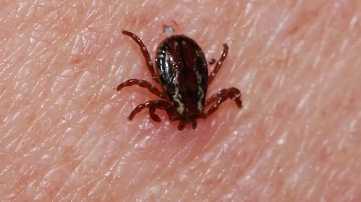 Kendimizi keneden korumak için bazı önlemler almamız lazım. Kırsal alanlarda, piknik alanlarında veya çayır çimende gezerken pantolonlarımızın paçalarını çorabın içine sokabiliriz. Kenenin tutunacağı bir deri yüzeyi bırakmayarak kendimizi koruyabiliriz. Kene konusunda neler yapılması gerektiğini bilmemiz önemli. Kene ısırması durumunda vatandaşlarımızın en yakın sağlık kuruluşuna başvurarak, kendileri keneyi çıkartmadan sağlık profesyonellerinden yardım almasını istiyoruz"