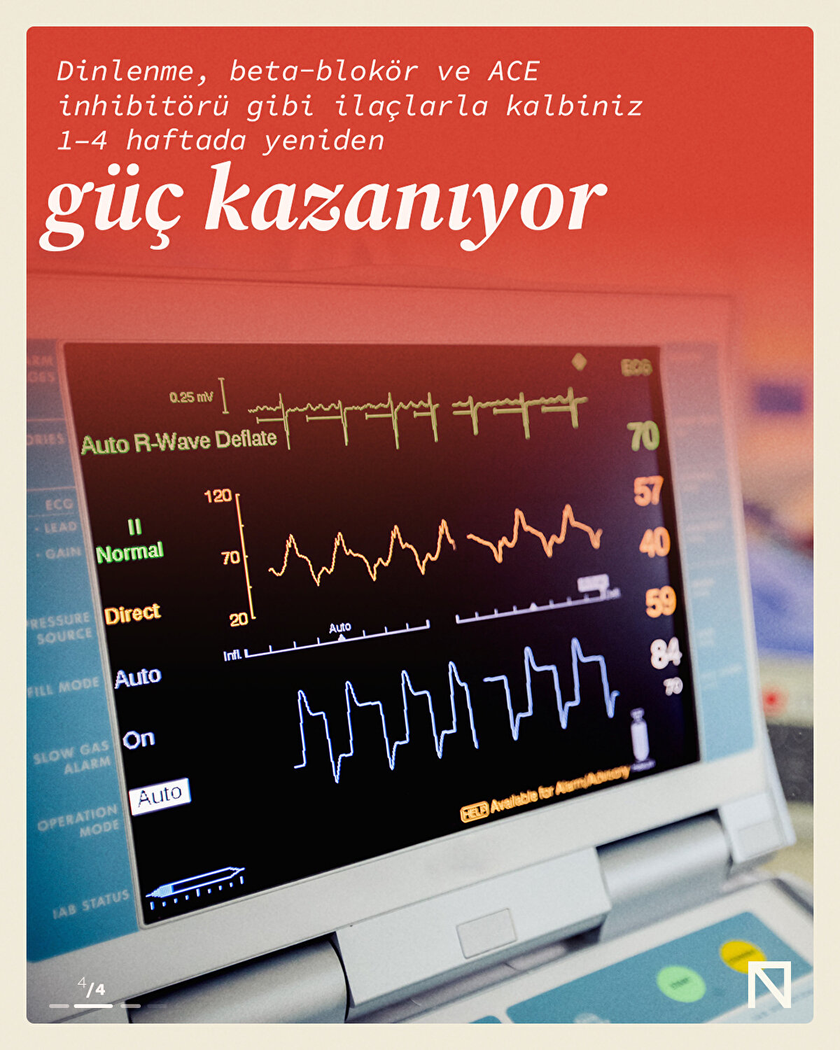 Tedavi Yaklaşımları<br><br>Tedavi protokolü destekleyici olup dinlenme, beta-blokör ve ACE inhibitörü kullanımı; gerekirse diüretik ve antikoagülan eklenmesiyle yürütülür. Psikososyal destek ve stres yönetimi teknikleri (meditasyon, nefes egzersizleri) hem akut dönemde hem de tekrarı önlemede kritik öneme sahiptir.