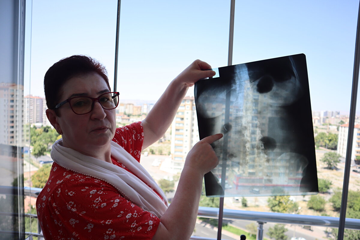 Yaşayan ölü gibiyim<br><br>MR cihazına giremediğinden ve günlük hayatındaki engellerinden bahseden Tanyıldız, “Yaşayan ölü gibiyim. Psikolojim bozuldu, kendime gelemedim. Hala o ağrıyla yaşayan ölü gibiyim. MR’a da giremiyorum, hiçbir derdimi sonuçlandıramıyorum. Yürürken nefes nefese kalıyorum, korse takıyorum. Çünkü korse takmadan hızlı yürüyemiyorum, adeta batıyor. Hiçbir hastalığımı sonuçlandıramıyorum, sağlık sorunum var” dedi.