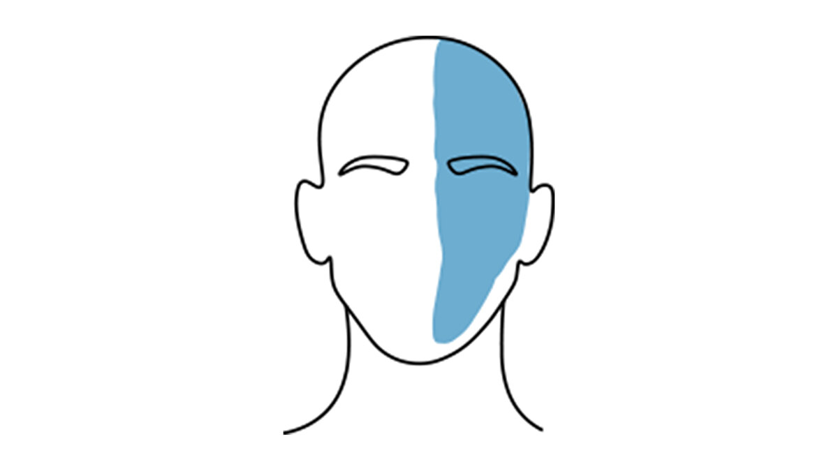 Migren<br><br>Genellikle başın tek tarafında görülür