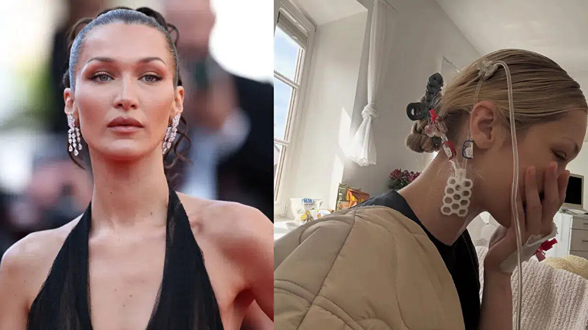 Bella Hadid hastalığı nedir?<br><br>Bella Hadid’in uzun süredir mücadele ettiği hastalık Lyme olarak biliniyor. Lyme hastalığı, Borrelia burgdorferi adlı bakterinin neden olduğu ve genellikle enfekte kene ısırığıyla bulaşan ciddi bir enfeksiyon hastalığıdır.