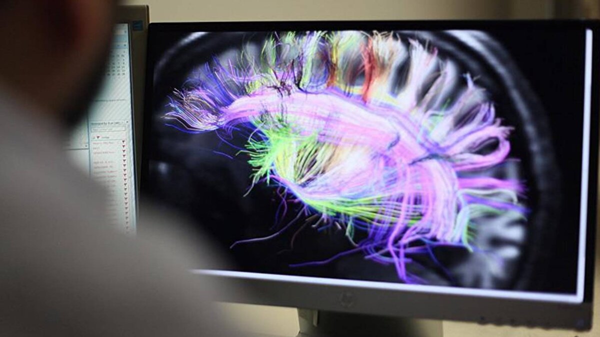 Yaklaşık 1,3 kilo ağırlığındaki beynin dörtte üçü, neokorteks adı verilen bölgeden oluşuyor. Bu bölgeler dil, hafıza, problem çözme ve öz farkındalık gibi gelişmiş bilişsel işlevlerden sorumlu.