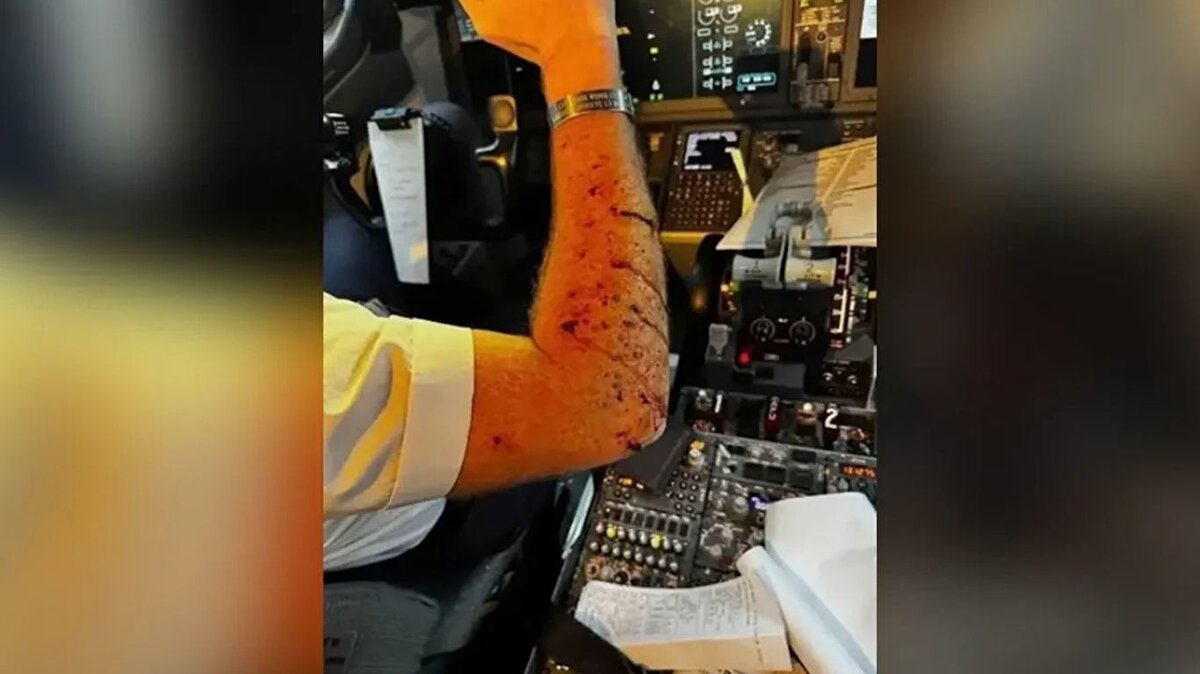 İniş güvenli olarak gerçekleşti<br><br>United Airlines ise kazaya ilişkin açıklamasında şu ifadelere yer verdi:<br><br>''United'ın 1093 sefer sayılı uçuşu, çok katmanlı ön camındaki hasarı gidermek için Salt Lake City'ye güvenli bir şekilde indi. Aynı günün ilerleyen saatlerinde Los Angeles'a gidecek müşterileri götürecek başka bir uçak ayarladık ve bakım ekibimiz uçağı tekrar hizmete sokmak için çalışıyor.''