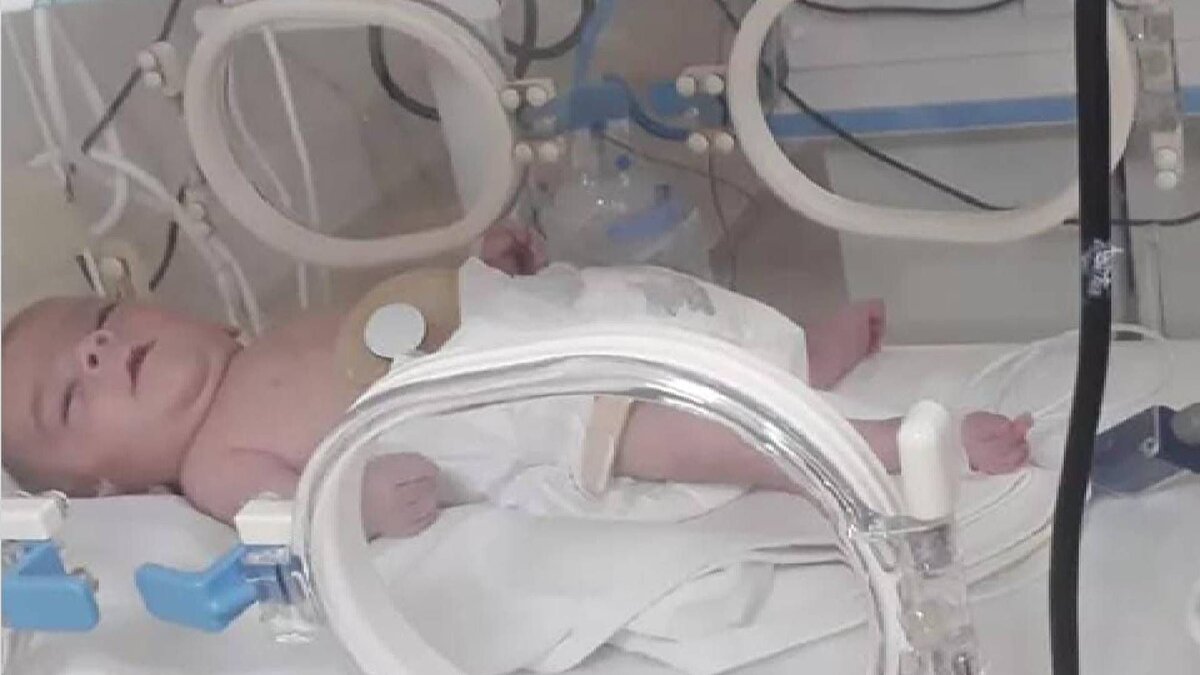 Bu durumu kabullenmiştik<br><br>Abdullah Bozoklar, doğumun normal bir şekilde gerçekleştiğini ve gelişim sorunu nedeniyle kızının kuvöze alındığını, 2 ay sonra da kızının bacağının kırıldığını öğrendiklerini söyledi. Hastanenin kendilerine herhangi bir açıklama yapmadan Deniz Esin’i entübe bir şekilde özel bir hastaneye sevk ettiğini belirten Bozoklar, “Orada da çocuğa epilepsi ve serebral palsi teşhisi konuldu. Bunun nedenini de bu çocuğun beyninde herhangi bir hasar olduğunu, neden kaynaklı olduklarını bilmediklerini söylediler. Biz çocuğu kuvözden çıkarttıktan sonra bu şekilde bir durum olduğunu kabullenip hayatımıza devam ederken 2024 yılında Haziran ayında bize e-Devlet'ten çocuğumuzun mahkemesinin geldiğini gördük, kamu davası açılmış hemşire hakkında. Bu şekilde haberimiz oldu. Yani bu çocuk darp edilmiş, bizim 3 yıl sonra haberimiz oluyor. Orada bir hemşire kızımızı darp ediyor. Bu kamera görüntüleriyle, Erciyes Üniversitesi Tıp Fakültesi'nde bu sabitleniyor. Bacağını kırıyor, kafasına vuruyor, ters bir şekilde çeviriyor kızı. Yani bu şekilde yani canice bir hareketlerde bulunuyor” dedi.<br><br>Kızının engelli kalmasında hastanenin ihmali olduğunu belirten Bozoklar, “Yani hemşire bu hataları yapmış. Devamında bu çocuk 5 gün kırık bacakla yaşıyor, hiçbir müdahale olmuyor. Bir hemşirenin bacak kırmasıyla başlayan, hastanenin 5 gün boyunca müdahale etmemesiyle devam eden bir süreç, Hemşire ve hastane ortaklığıyla el ele verip bu hale getirmişler kızımı. Bu hemşire şu an elini kolunu sallaya sallaya geziyor. Görevden alındı, sadece bununla yetiniyor. Bunun görevden alınması bizim çocuğumuzu geri getirmeyecek. Serebral palsi hastalarının 13-15 yaş gibi bir ömrünün olduğunu biliyoruz. Yani bunun devletimizden bu işin peşini bırakmayacaklarını umuyoruz, güveniyoruz. Bizim adalete olan güvencemiz tamdır. Biz bu işin peşini bırakmayacağız, her zaman da arkasında duracağız kızımızın” dedi.