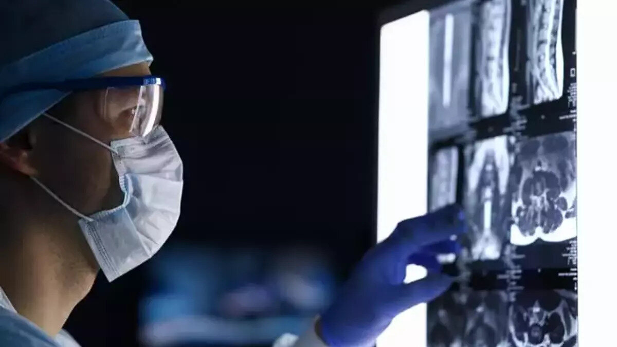 Deli dana hastalığı ilk olarak 1986 yılında İngiltere’de büyükbaş hayvanlarda tespit edilmişti. Hastalık kısa sürede insanlara da bulaşarak 178 kişinin ölümüne yol açmış ve 1990’lı yıllarda tüm Avrupa’yı etkisi altına almıştı. Uzmanlar, benzer bir riskin Türkiye’de yaşanmaması için hayvan ürünlerinin güvenilir kaynaklardan alınması ve sakatat tüketiminde dikkatli olunması konusunda uyarıyor.