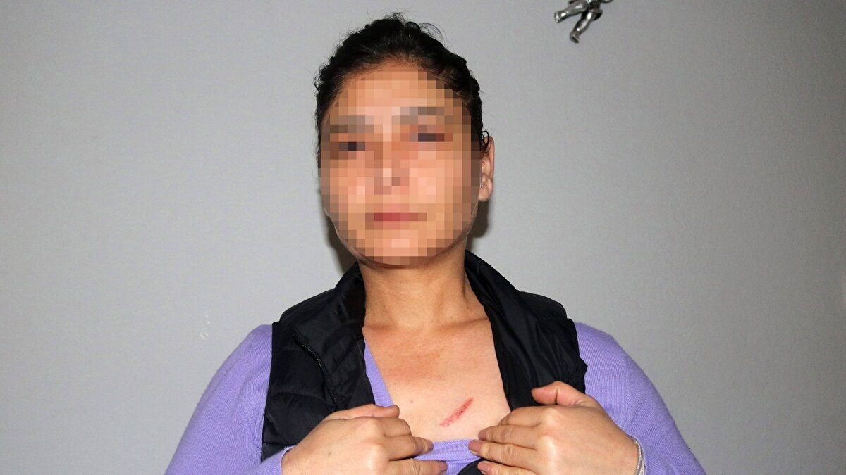 "Deli numarası yaptı"<br><br>Sanığın en ağır şekilde cezalandırılmasını isteyen Tezcan K., duruşma sonrası yaptığı açıklamada, "Bu kişi, aklı yerinde olmayan bir insan olsaydı böyle planlı düzenek hazırlayıp bir kişiyi öldürmeye teşebbüs edemezdi, bu nedenle en ağır cezayla yargılanmasını istiyorum. Bu kişinin yaptıkları kasıtlı ve tehlikelidir. Deli numarası yaparak bu davranışları sergilemesi de suç unsurudur. Yaşadığım mağduriyetin dikkate alınmasını, gerekli yasal işlemlerin titizlikle yürütülmesini ve kamu güvenliği açısından gerekenin yapılmasını talep ediyorum" diye konuştu.