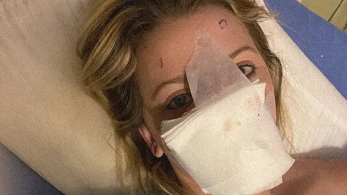 Kadın, köpeğin saldırısının kasıtlı olmadığını düşündüğünü, hayvanın sadece büyük ve güçlü olduğu için zarar verdiğini belirtti. Wilson, benzer yüz travmaları yaşayan insanların birbirine destek olmasının önemine dikkat çekerek, “Aynı şeyi yaşayanları görmek insanı daha az yalnız hissettiriyor” sözleriyle yaşadıklarını paylaştı.