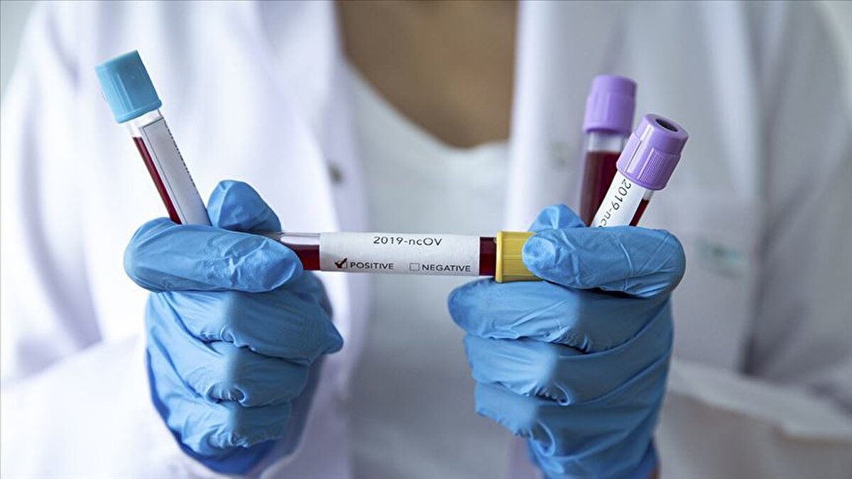 Yoğun spor sonrası risk artabiliyor<br>Kovid-19 geçiren ve eski spor temposuna hızla dönen gençlerde ani kalp krizlerinin görülebildiğini belirten Özkaya, kılcal damarlarda oluşan hasarın yoğun egzersiz sırasında yeterli oksijenlenmeyi engelleyebildiğini ve bunun ani ölüme kadar uzanabilen ciddi bir tabloya yol açabileceğini kaydetti.