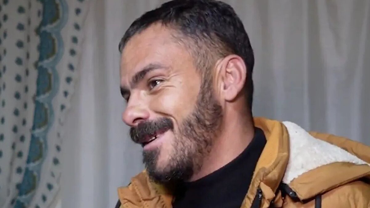 Milyonda bir rastlanan durum<br><br>Gürler, sosyal medyada benzer olayları araştırdığını, ancak örneğine rastlamadığını söyledi. 34 yaşında başına gelen bu olayın çok nadir görüldüğünü belirten Gürler, “Hayatımda ilk kez böyle bir şey yaşadım. Milyonda bir şansla karşılaşılmış bir durum” dedi.