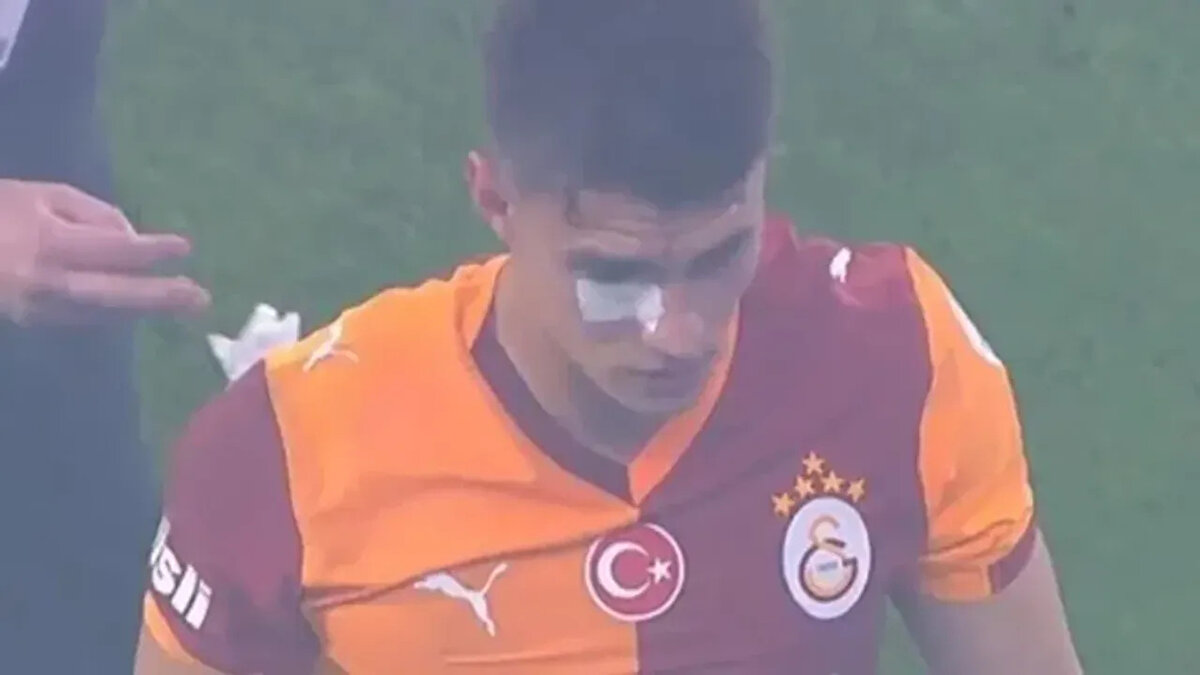 Süper Lig'de Galatasaray'ın Fenerbahçe ile oynadığı derbide Kazımcan Karataş'a tribünden yabancı madde geldi.