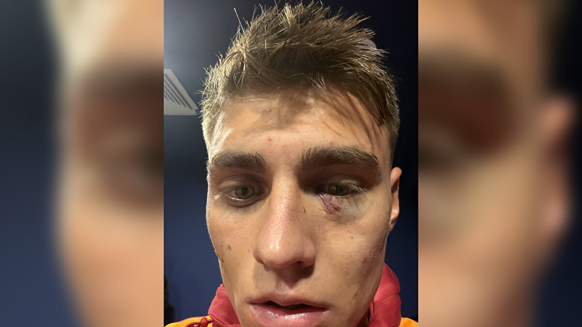 Maçın ardından Galatasaray sosyal medya hesabından, "Yüzündeki yara, alnımızın akıdır!" paylaşımını yaptı. 