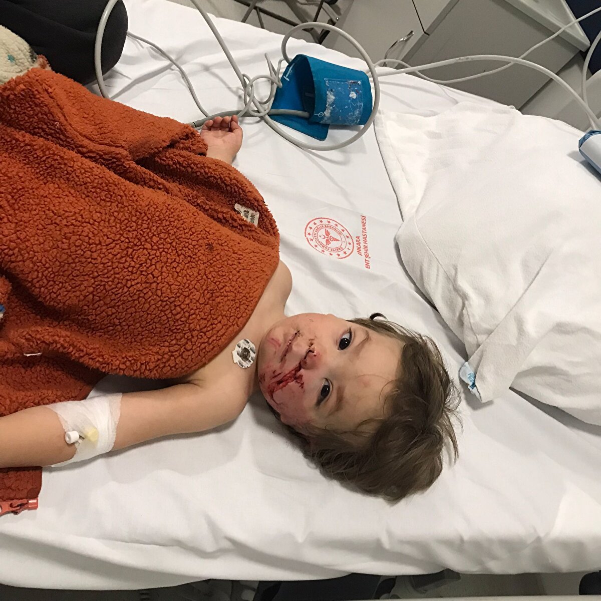 Saldırıda göğsünden yaralanan Doğa taburcu edilirken, yüzünden ağır darbe alan küçük Efe’nin tedavisi Bilkent Şehir Hastanesi’nde devam ediyor. Süreci anlatan baba Adem Öztürk, yaşadıkları anların kendilerini derinden sarstığını söyledi.