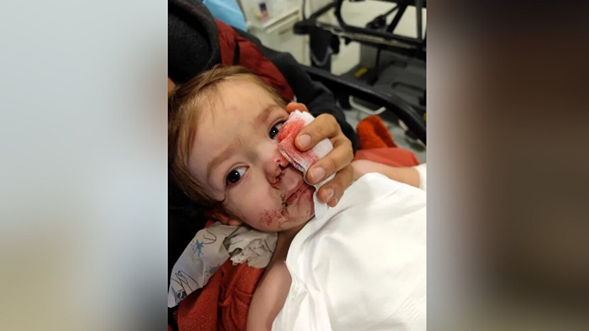 Köpeği başka adrese götürmüş<br><br>Savcılık kaydına yansıyan ifadeye göre Erol, saldırıdan sonra annesinin köpeği içeri aldığını haber vermesi üzerine iş yerinden çıkarak eve döndü. Köpeğin zarar göreceği endişesiyle hayvanı Kahramankazan’daki başka bir adrese götürdüğünü; daha sonra da yerini güvenlik birimlerine bildirdiğini aktardı. Köpek, Etimesgut Belediyesi ekiplerince alınarak barınağa götürüldü.