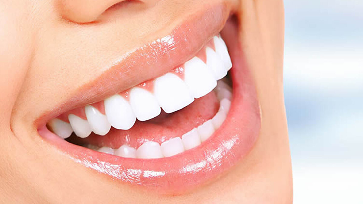 Yapılacak implantların "Yerli Üretim" olması,<br><br>Kişi başı "En fazla 4 adet" ile sınırlı tutulması öngörülüyor.<br><br>Bu şartların sağlanması halinde, vatandaşın implant masrafını kurum üstlenecek.