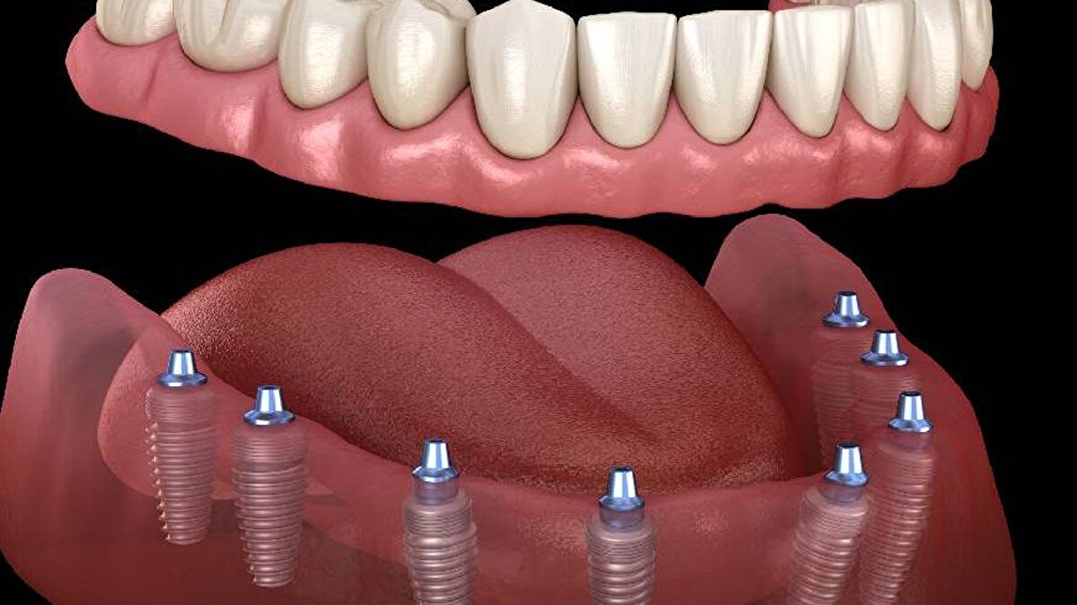 Türkiye Büyük Millet Meclisi (TBMM), sağlık alanında devrim niteliğinde bir teklifi gündemine aldı.