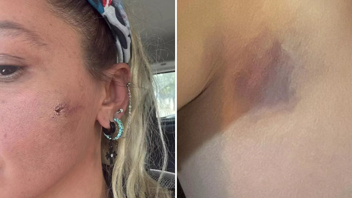 Tepki ve destek mesajları arttı<br><br>Paylaşımının ardından sosyal medyada geniş bir tartışma başladı. Kullanıcılar Asyalı’ya geçmiş olsun dileklerini iletirken, yetkililere başvurması yönünde çağrılar yapıldı. Asyalı’ya çok sayıda oyuncu ve takipçisinden de dayanışma mesajları geldi.