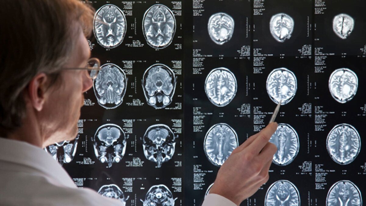 Teşhise giden süreç
<br><br>Doktorların başlangıçta kas zorlanması olarak değerlendirdiği durum, Isom’un günlük işlerde zorlanmasıyla daha da belirginleşti. Özellikle sol elini kullanmakta güçlük çekmeye başlayan Isom, tekrar hastaneye başvurdu. Yapılan etkilerde altı santimetrelik kitlenin ortaya çıktı.Yapılan MRI taraması, kitlenin yağ hücrelerinde gelişen liposarkom olduğunu doğruladı.