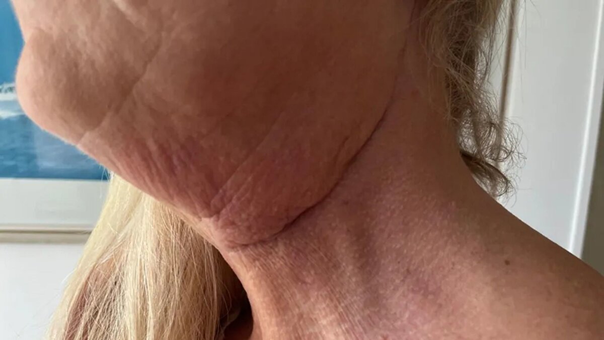 Farkındalık ve önleme <br><br>Blair, sigara kullanmadığını, alkolü sınırladığını ve haftada beş gün egzersiz yaptığını belirtti. Şimdi amacı, ağız kanseri farkındalığını artırmak. Sosyal medya üzerinden tedavi sürecini paylaşarak erken teşhisin önemini vurguluyor ve herkesi, ağızda iki-üç haftadan uzun süren yaralar veya değişiklikler için doktora başvurmaya çağırıyor.